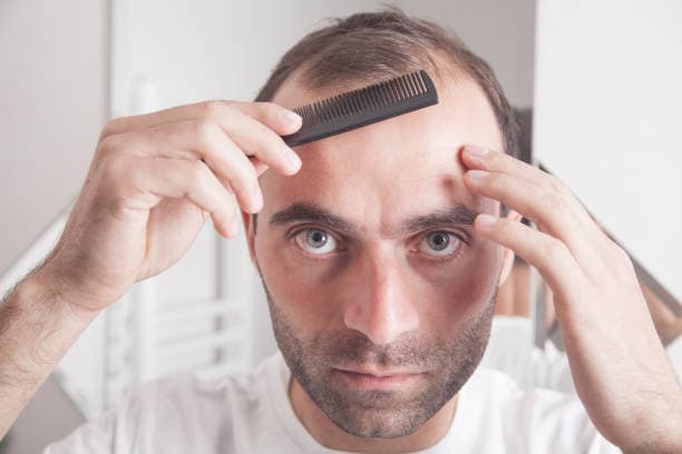 Hair Transplant Price Guide for International Patients
