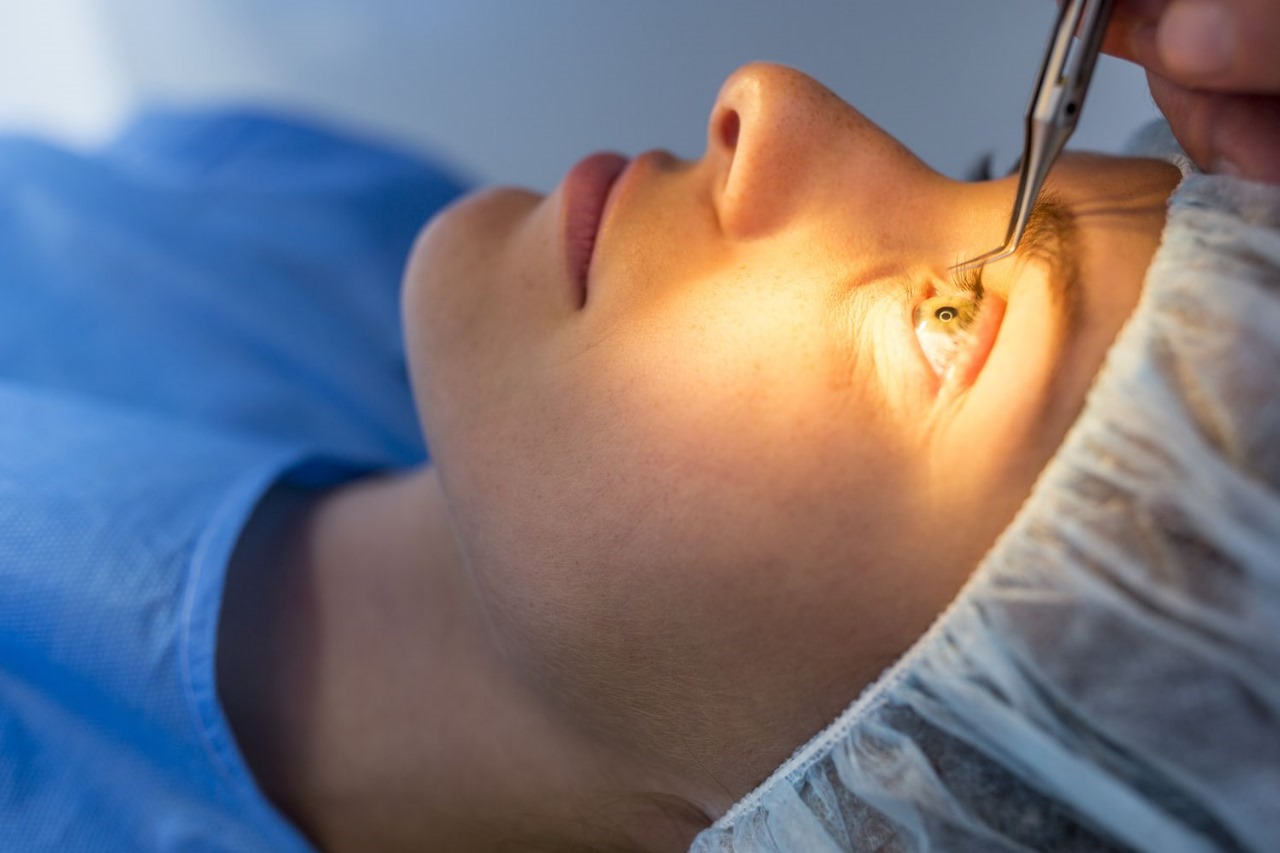 Choosing the Best Surgeon for LASIK Turkey