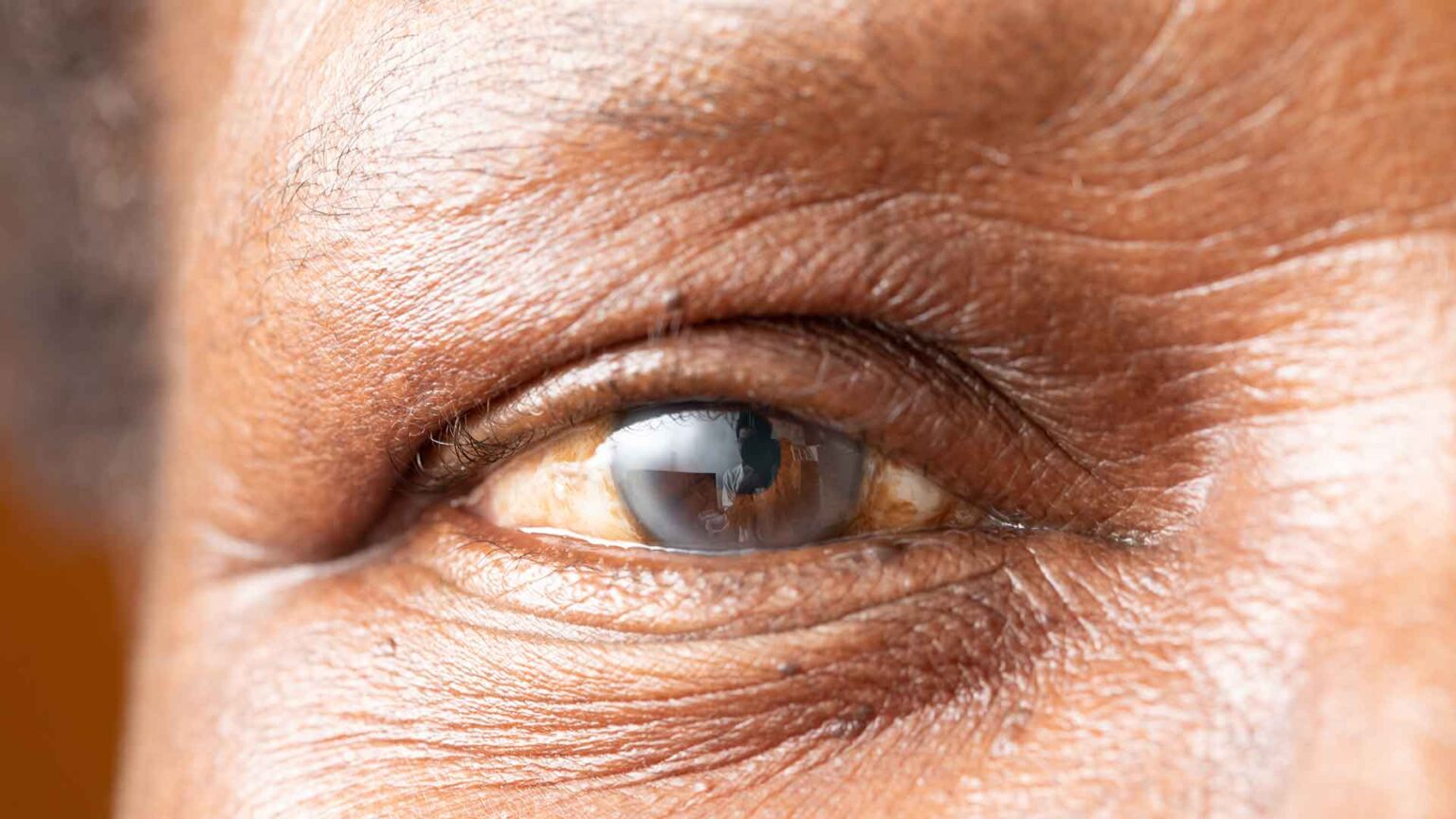 The Comprehensive Guide to lasik turkey price: What You Need to Know